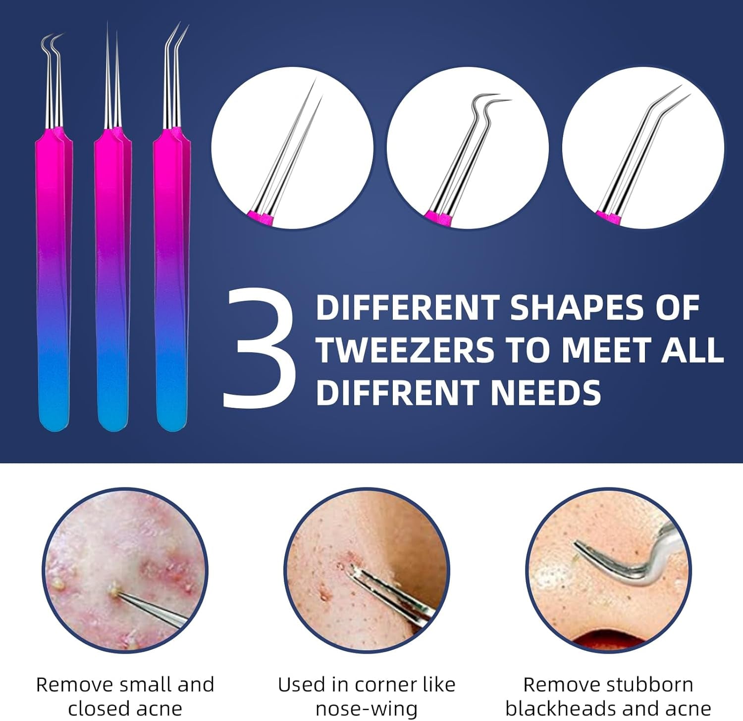 Blackhead Extractor Tools,  10 Pcs Professional Pimple Popper Tool Kit with Metal Case for Quick and Easy Removal of Blackheads,Pimples,Zit Removing,Facial and Nose(Colorful)